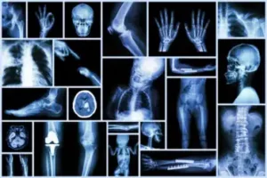 Radiografias em crianças: o que você precisa saber