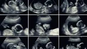 Ultrassonografia de 20 semanas: por que é tão importante?