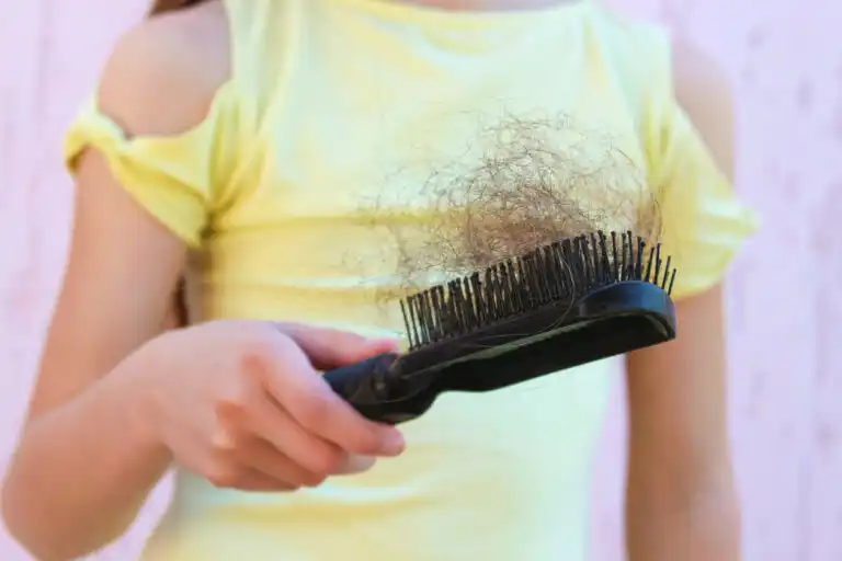 Queda de cabelo na adolescência: sintomas, causas e tratamento