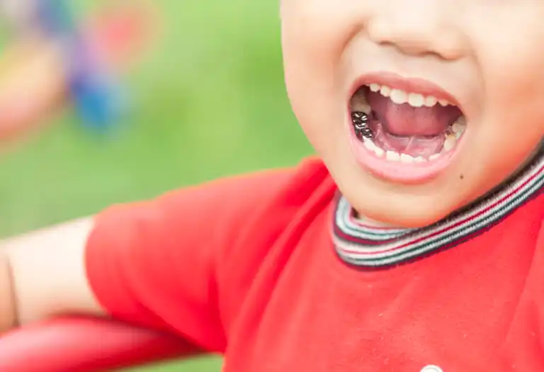 6 benefícios das coroas dentárias para crianças