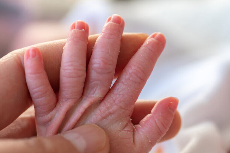 10 recomendações para cuidar da pele de bebês prematuros