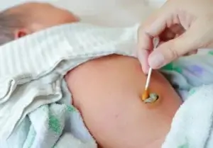 Onfalite ou infecção do umbigo no recém-nascido