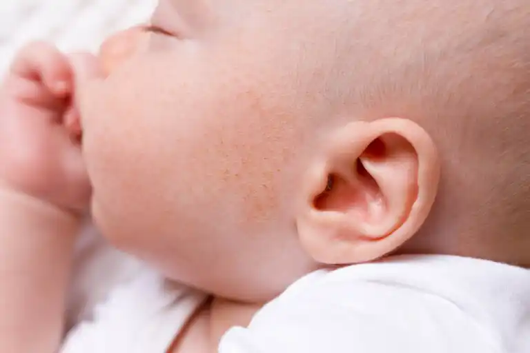 Espinhas no rosto do bebê: a que se devem e o que fazer?
