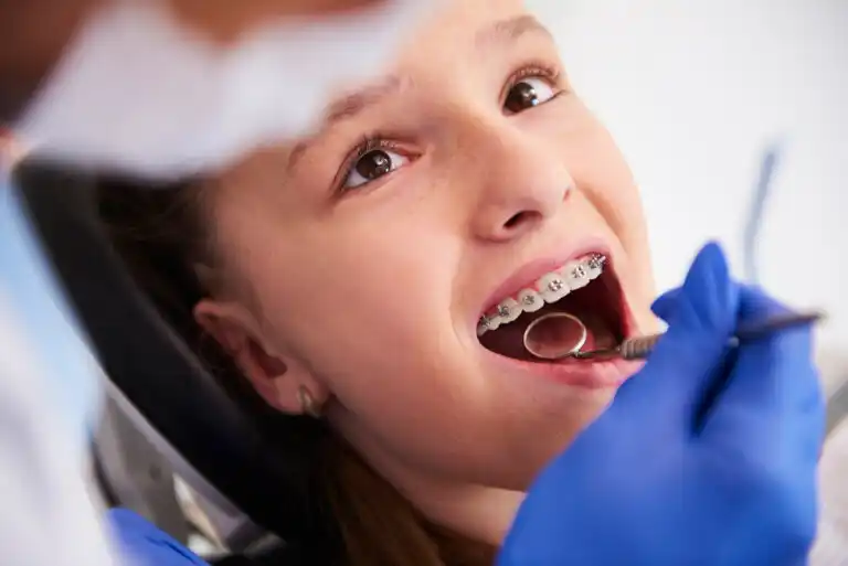 Ortodontia precoce em crianças: expansão ou extrações dentárias?