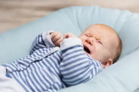 Como evitar irritações na pele dos bebês?
